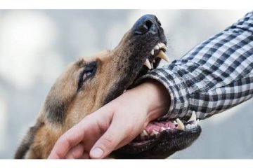 Dog Bite Attorney: When Do I Need One?